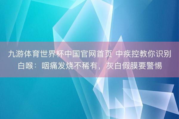 九游体育世界杯中国官网首页 中疾控教你识别白喉:咽痛发烧不稀有,灰白假膜要警惕